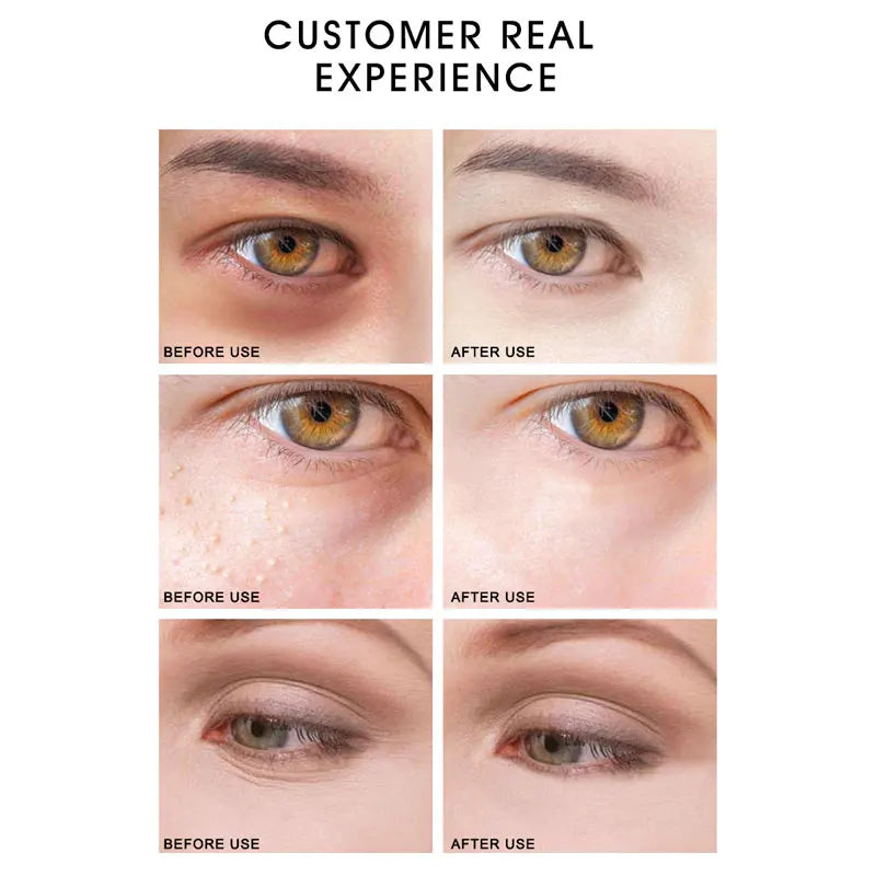 ARTISCARE Black Pearl + Seaweed Eye Mask 2pcs/Lot Moisturizing Fade Wrinkles Dark Circle Collagen Gel Eye Patches Eyes Care